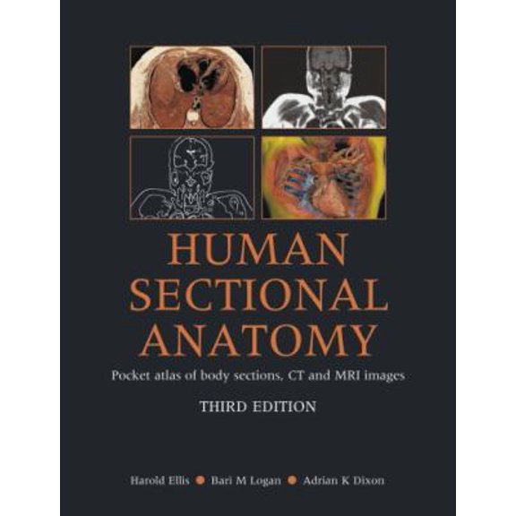 Pre-Owned Human Sectional Anatomy Pocket Atlas of Body Sections, CT and MRI Images (Paperback) 034098516X 9780340985168