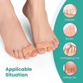 thumbnail image 3 of Welnove Pack of 12 Bunion Corrector, Toe Separators with 2 Loops, Big Toe Spacer Suitable for Bunion and Overlap Toe (White), 3 of 10