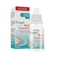 thumbnail image 3 of 10ml Fungal Nail Treatment Nail Foot Whitening Toe Fungus Removal Feet Care Repair Nail For O, 3 of 5