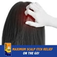 thumbnail image 2 of 6 Pack - Scalpicin Max Strength Scalp Itch Treatment, 1.5 oz, 2 of 3