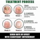 thumbnail image 4 of Nail Fungus Treatment, Ginger Nail Fungus Treatment, Toenail Cuticle Care Oil Care, Fungal Nail Treatment, 7 Days Nail Fungus Treatment for Toenail_c*, 4 of 5