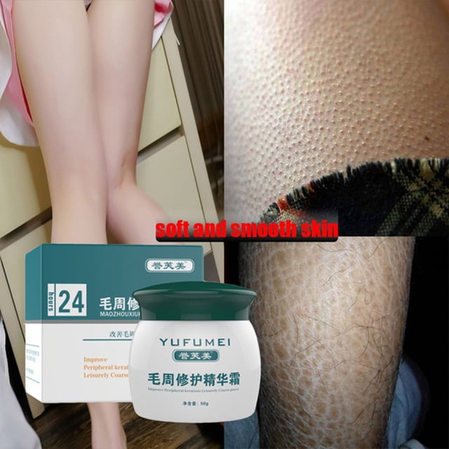 Fiudx Crema Reparadora, Hidratante Antiedad, Loción Corporal con Extractos Naturales, Fórmula Reductora de Melanina, Tratamiento Acondicionador de La Piel, Cuidado Diario de La Piel, Envase Ligero de