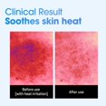 thumbnail image 3 of Mascarilla facial SOME BY MI Beta-Panthenol Repair Daily 30 hojas, 3 of 9