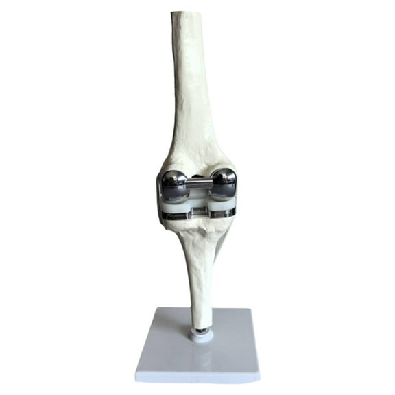 Knee Joint Model Simulation Replacement Surgery Meniscus Ligament Cartilages Surgery Model,Artificial Knee Joint