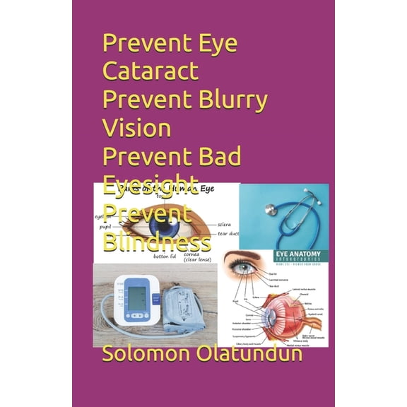 Prevent Eye Cataract Prevent Blurry Vision Prevent Bad Eyesight Prevent Blindness, (Paperback)