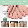 thumbnail image 4 of 20ML Nutraboost Nail Fungus Treatment Gel, Natural Nail Repair Strengthening Gel 1/3/5x, 4 of 5