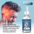 thumbnail image 3 of Tinnitus Relief Solution For Inner Ear Obstruction Tinnitus On The Back Of The Ear And Discomfort In The Ear Cochlea, 3 of 4