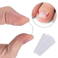 thumbnail image 1 of Ingrown Toenail Pedicure Tool 10pcs/bottle Straightening Curved Bs Brace Toenails Thick Paronychia, 1 of 5