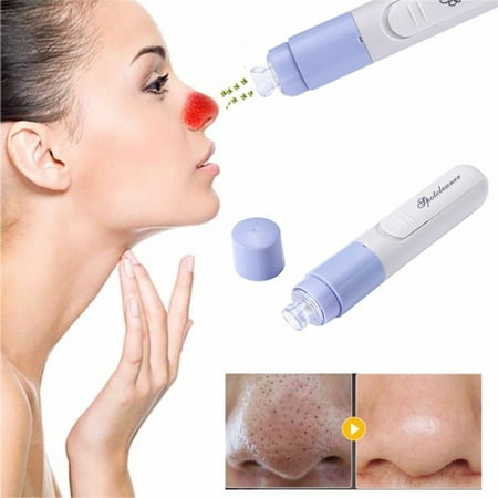 Anauto Electric Facial Pore Cleanser Cleaner Kit Face Blackhead and Whitehead Acne Vacuum Suction Remover No squeezing, no piercing, no (Best Way To Squeeze Blackheads)