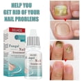 thumbnail image 1 of 1pc Fungal Nail Treatment Liquid Nail Repair Moisturizing Anti-bag Nursing Liqui, 1 of 5
