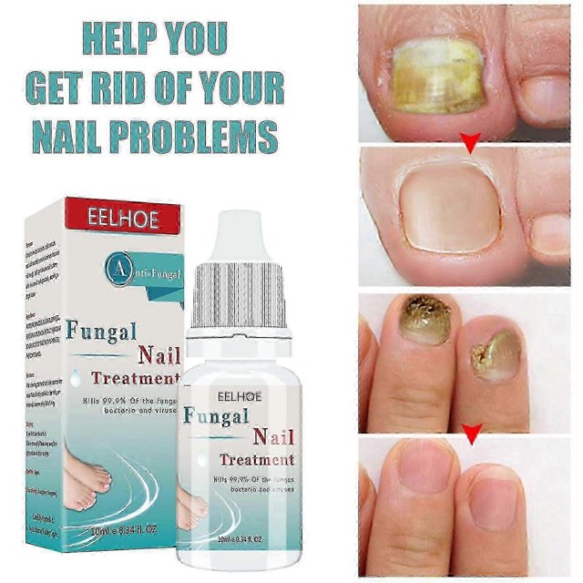 1pc Fungal Nail Treatment Liquid Nail Repair Moisturizing Anti-bag Nursing Liqui