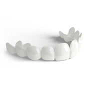 BilVeneers Double Arch