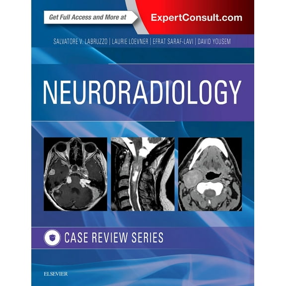 Neuroradiology Imaging Case Review