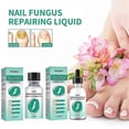 thumbnail image 4 of New Kerassentials For Toenail Fungus, Kerassentials Toenail Fungus Treatment Oil, 4 of 4