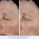thumbnail image 4 of Crema hidratante facial Obagi ElastiDerm Lift Up & Sculpt 50 ml, 4 of 9