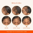 thumbnail image 3 of RED by Kiss Growth MD Hair Growth Scalp Ampoule, Scalp Strengthening 10X Biotin and Rosemary Oil Infused, Made with 100% Natural Ingredients, USDA Certified Organic Oils, Non-GMO, 3 of 8