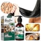 thumbnail image 5 of Jaysuing Garlic Shampoo, Anti-itching Hair, Anti-dandruff Shampoo, Anti-hair Loss And Nourishing Hair Shampoo & Conditioner 1pcs |, 5 of 5