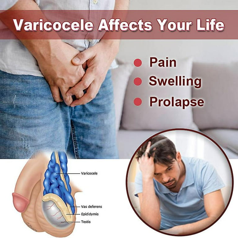 Ungüento para varicocele testicular, 3 uds., crema para venas varicosas para escroto, tratamiento para venas varicosas, ungüento de hierbas sin efectos secundarios A641// kaili Sencillez