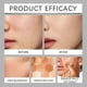 thumbnail image 5 of Changing Foundation Nature Colour-Changing Foundation for Women, Hydrating Magic Skin Changing Foundation, Moisturizing Light Weight Non-Greasy, 5 of 5