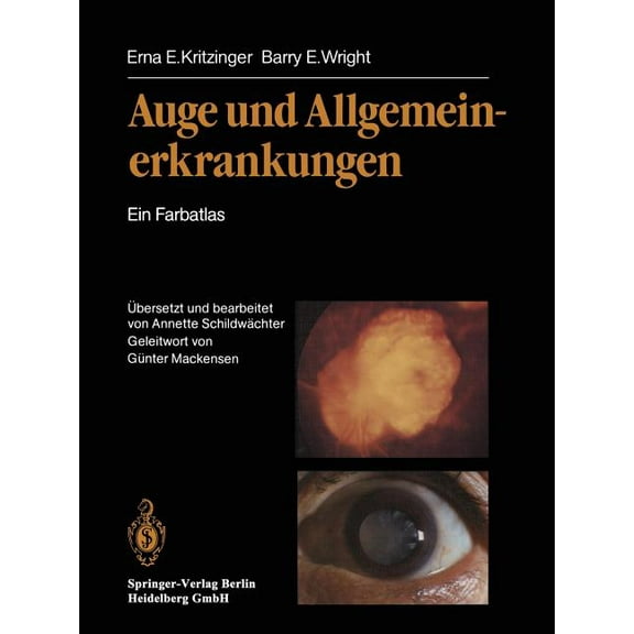 Auge Und Allgemeinerkrankungen: Ein Farbatlas, (Paperback)