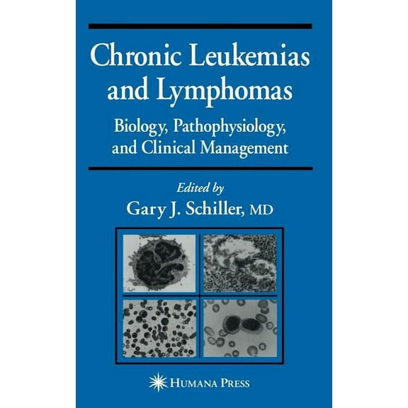 Current Clinical Oncology Chronic Leukemias and Lymphomas: Biology, Pathophysiology, and Clinical Management, (Hardcover)
