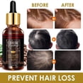 thumbnail image 2 of Sérum para el crecimiento del cabello con biotina y cafeína, aceite capilar multiusos para cabello seco, dañado y con puntas abiertas., 2 of 5