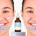 thumbnail image 4 of Sérum Cosmedica Skincare con ácido hialurónico + B5, 60 ml, antienvejecimiento, 4 of 5