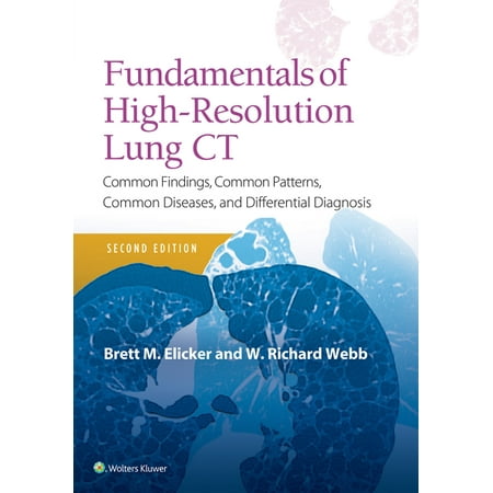 UPC: 9781496389923 | Fundamentals of High-Resolution Lung CT: Common Findings  Common Patterns  Common Diseases and Differential Diagnosis (Paperback)