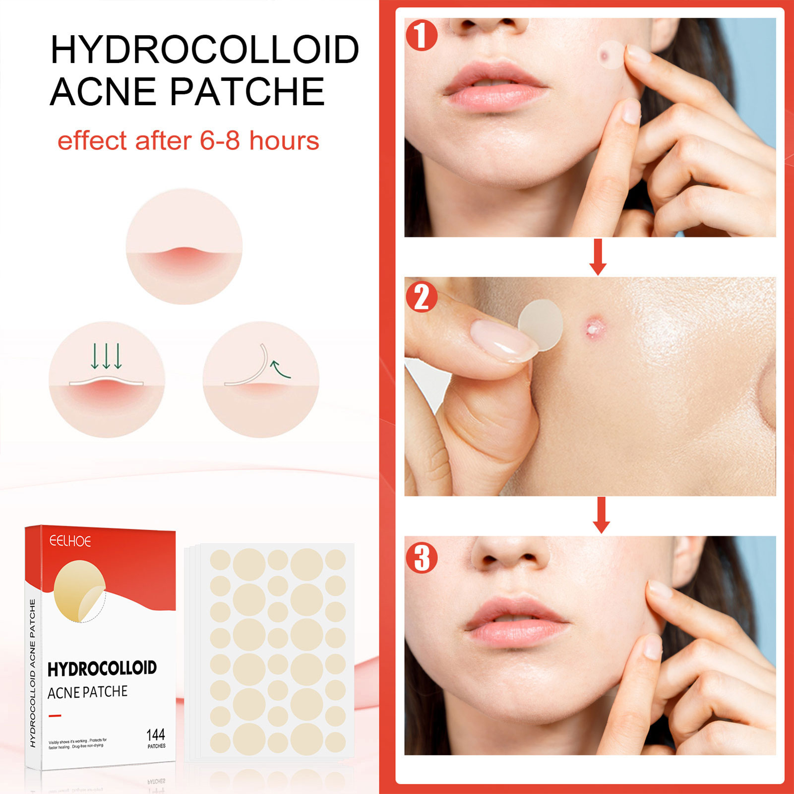 Hydrocolloid Acne Treatment Patches Lighten Acne Reducing Acne Marks