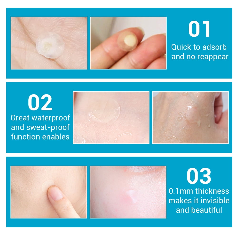 acne pimple patch lanbena