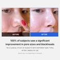 thumbnail image 4 of Medicube Zero Pore Pad 155 gramos Pads para piel grasa, 4 of 7