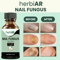 thumbnail image 5 of Herbiar Nail Fungus Treatment for Toenail & Fingers Extra Strong Fungal Nail Treatment Solution 30ML, 5 of 8