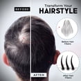 thumbnail image 2 of Elevate Hair Fibers to Instantly Thicken & Completely Conceal Thinning Balding Areas Loss in 30 Seconds for Men & Women (BLACK) 28g Size - 100% Natural & Undetectable Keratin Fibers, 2 of 7