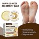 thumbnail image 2 of Crema anti-sequedad y peeling para pies agrietados South Moon Crema reparadora para talones agrietados Eliminación de piel muerta | |, 2 of 4