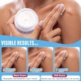 thumbnail image 2 of Vogisg Silicone Scar Gel and Scar Cream (2-PCS Set),Deep Hydrate and Soften, New and Old Scar Removal, 2 of 10