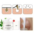 thumbnail image 4 of Crema para eliminar puntos negros con tiras para los poros, mascarilla de barro despegable para tratamientos de cuidado de la piel y limpieza de la nariz contra el acné a base de plantas, 4 of 6