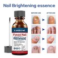 thumbnail image 4 of Nail Repair Solution Quick Absorption Nail Strengthening Liquid for Men Women, 4 of 5
