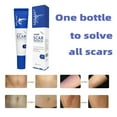 IHGEHA body care for women Scar Removal Proliferation Scar Gel Scar Removal Stretch Marks And