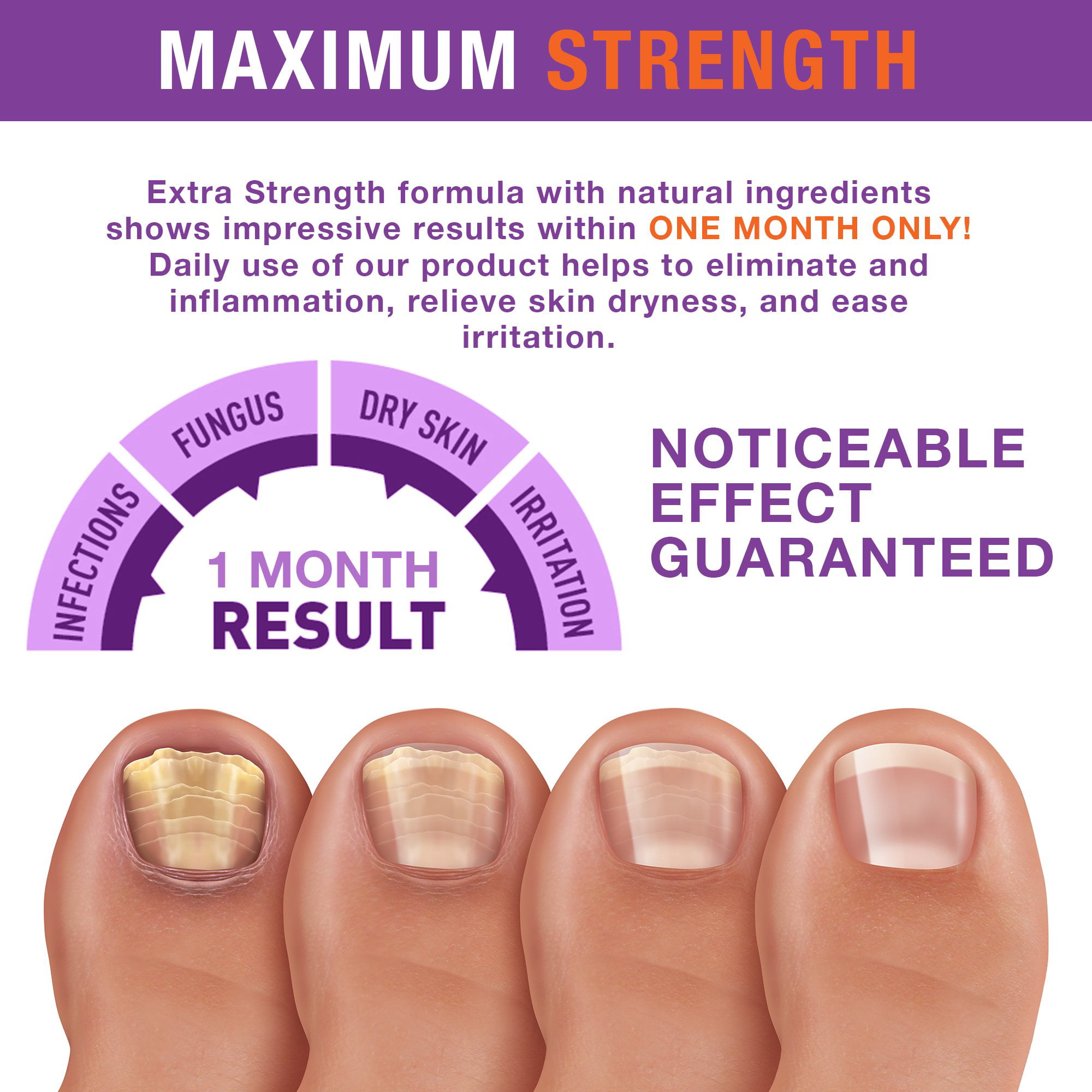 Lotrimin AF Athlete's Foot Antifungal Cream, 0.42 Ounce Tube - Walmart.com