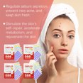 thumbnail image 4 of 240pcs Acné de ácido salicílico parches Star Pimple parche acné colorado invisible eliminación del acné cuidado de la piel pegatinas mancha de la cara corrector, 4 of 5