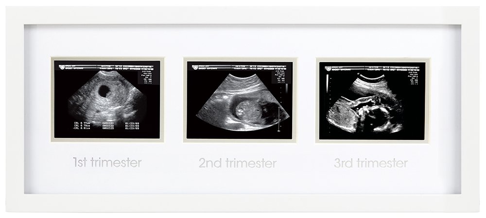 Free Free Baby Ultrasound Svg 892 SVG PNG EPS DXF File