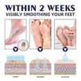 thumbnail image 4 of 1pc Jaysuing Anti-crack Repair Hand Cream Exfoliate To Improve Cracked And Rough Skin Moisturizing Moisturizing Hand Cream, 4 of 4