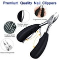 thumbnail image 2 of Ingrown Nail Solution With Comfort Grip, Rust-Free Stainless Steel Toenail Clipper, Professional Grade Tool For Thick Nails, Ergonomic Handle Design, Wide Jaw Opening, Multi-Tool Pedicure Kit., 2 of 6