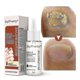 thumbnail image 1 of 1/2/3 Uds líquido de onicomicosis cóncavo y convexo áspero punto de uñas onicomicosis suave reparación de uñas Liqu, 1 of 5