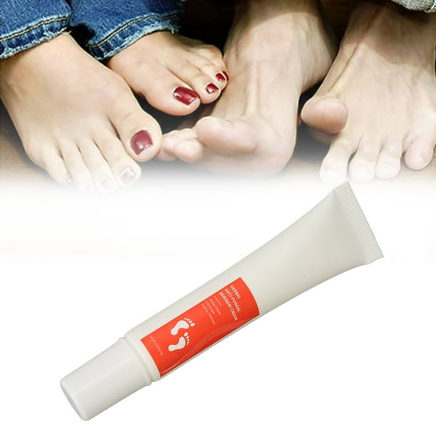 Cream for dry itchy feet deals