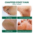 thumbnail image 4 of DHARMONAL Foot For Rough Thick Dry Skin Nourishing Moisturizing Foot Dry Heels And Feet Lotion Applicator for Feet File for Feet Dry Skin Remover Pedicure Flip Flops Pedicure Brush for Feet, 4 of 9