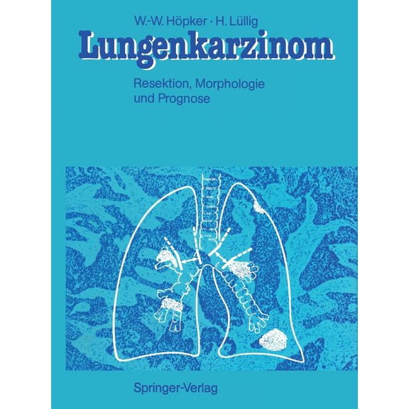 Lungenkarzinom: Resektion, Morphologie Und Prognose, (Paperback)