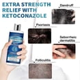 thumbnail image 4 of anti fungal scalp treatment for psoriasis, 4 of 5