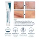 thumbnail image 5 of Crema de eliminación de cicatrices a base de hierbas, Gel quirúrgico para quemar cicatrices, cesárea, crema de tratamiento de estrías, cuidado suave de la piel, 5 of 5
