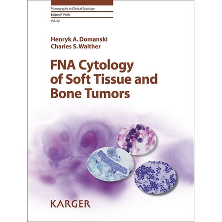 UPC: 9783318060768 | Fna Cytology of Soft Tissue and Bone Tumors (Monographs in Clinical Cytology) – Domanski  H.a.